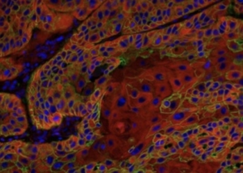 La UA participa en un estudio para mejorar el tratamiento contra el cáncer