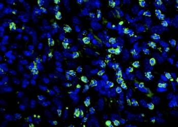 Un fármaco, ya aplicado en dolencias cardíacas, mejora la eficacia de las terapias frente al melanoma