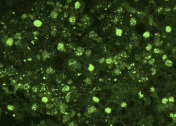 Un estudio liderado por el CSIC identifica una proteína esencial en la regulación de la obesidad