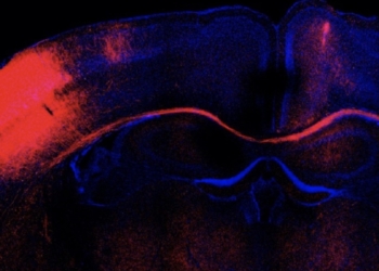 Identifican la implicación de un tipo minoritario de neuronas en el desarrollo del cerebro