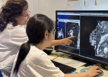 El Hospital Doctor Peset utiliza la resonancia magnética para abordar la cirugía y el tratamiento del cáncer de mama