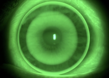 La UA realiza un estudio clínico para niños de entre 8 y 11 años para el control de la miopía