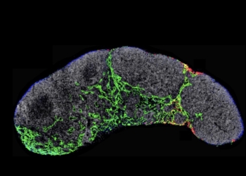 Día Mundial del Melanoma: avances del CSIC para frenar el cáncer de piel más agresivo
