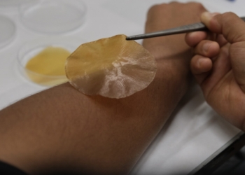 Crean apósitos que se activan con la luz solar para frenar la expansión de las infecciones bacterianas