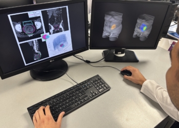 Ivace+i financia un proyecto para mejorar la precisión de los tratamientos de radioterapia que combaten el cáncer