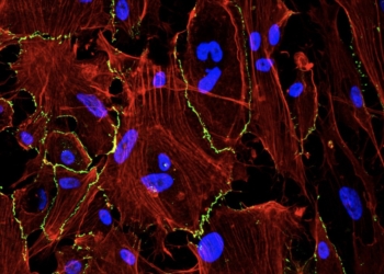 Un hidrogel en spray muestra resultados prometedores para prevenir complicaciones tras una cirugía abdominal