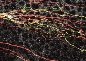 Una molécula activada por luz podría aliviar de forma no invasiva el dolor ocular en casos de ojo seco
