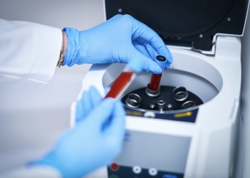 Un análisis genético de una muestra de sangre podría detectar el párkinson antes de los primeros síntomas