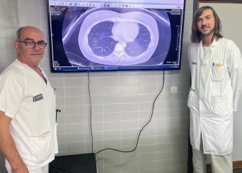 El Hospital Sant Joan d’Alacant desarrolla una IA que predice la respuesta al tratamiento biológico del asma grave y permite la lectura de los TAC de tórax