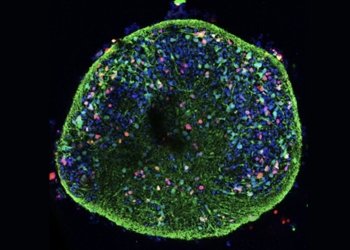 Un estudio del CSIC halla que el virus del herpes labial provoca alteraciones como las del alzhéimer